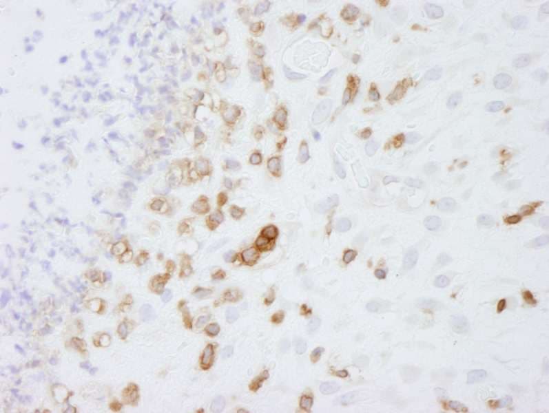 Polyclonal Rabbit anti-Human CORO1A / Coronin 1a Antibody (aa250-300, IHC)
