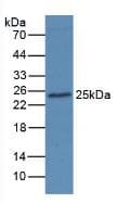 AGR2 Antibody (aa21-175, clone C1)