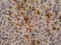 Alpha-Fetoprotein Antibody (clone AFP-11)