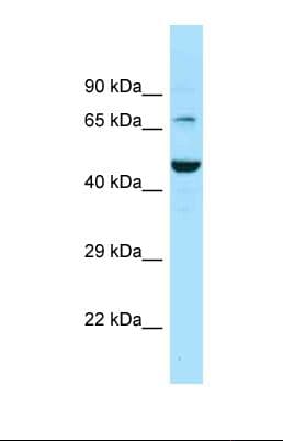 Polyclonal Rabbit anti-Human SLC6A11 / GAT-3 Antibody (C-Terminus, WB)