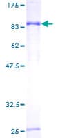 Human PGM3 Protein (Recombinant GST)