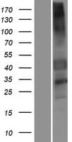 GPR151 Protein (Over-Expression Lysate Myc-DDK (Flag))