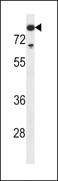 DNTT / TdT Antibody (aa42-70)
