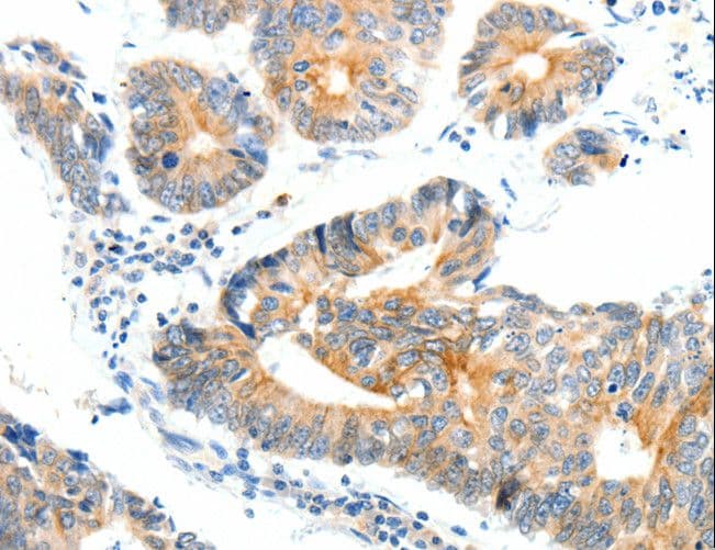 NTRK1 / TrkA Antibody