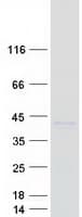 Human ST6GALNAC3 Protein (Recombinant Myc-DDK (Flag))