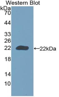 CALR / Calreticulin Antibody (aa199-308)