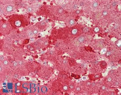 IHC-plus™ Polyclonal Rabbit anti-Human DUSP4 / MKP2 Antibody (Internal, IHC, WB)