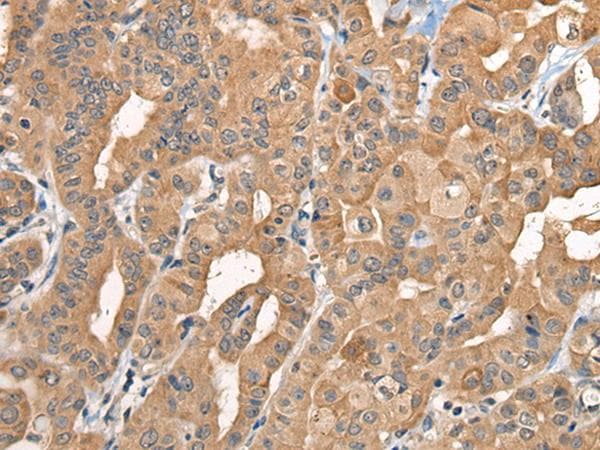 BCAN / Brevican Antibody