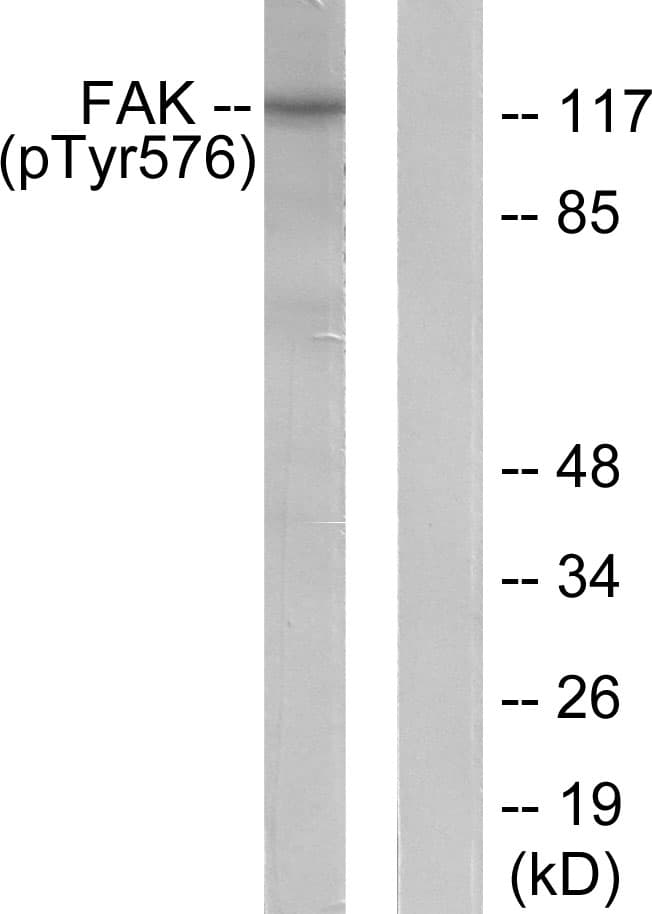 FAK / Focal Adhesion Kinase Antibody (phospho-Tyr576)