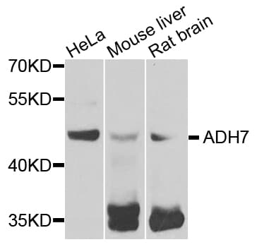 Polyclonal Rabbit anti-Human ADH7 Antibody (WB)