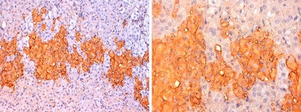 TH / Tyrosine Hydroxylase Antibody