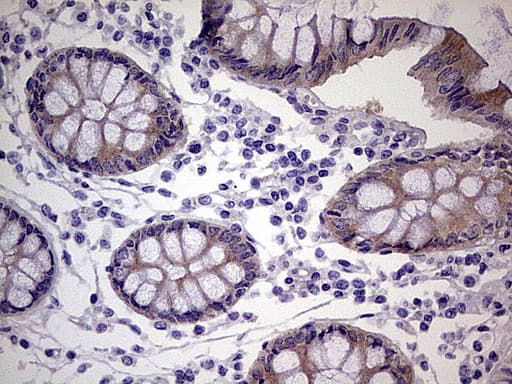 TACC2 Antibody (aa727-1026, clone OTI3G1)