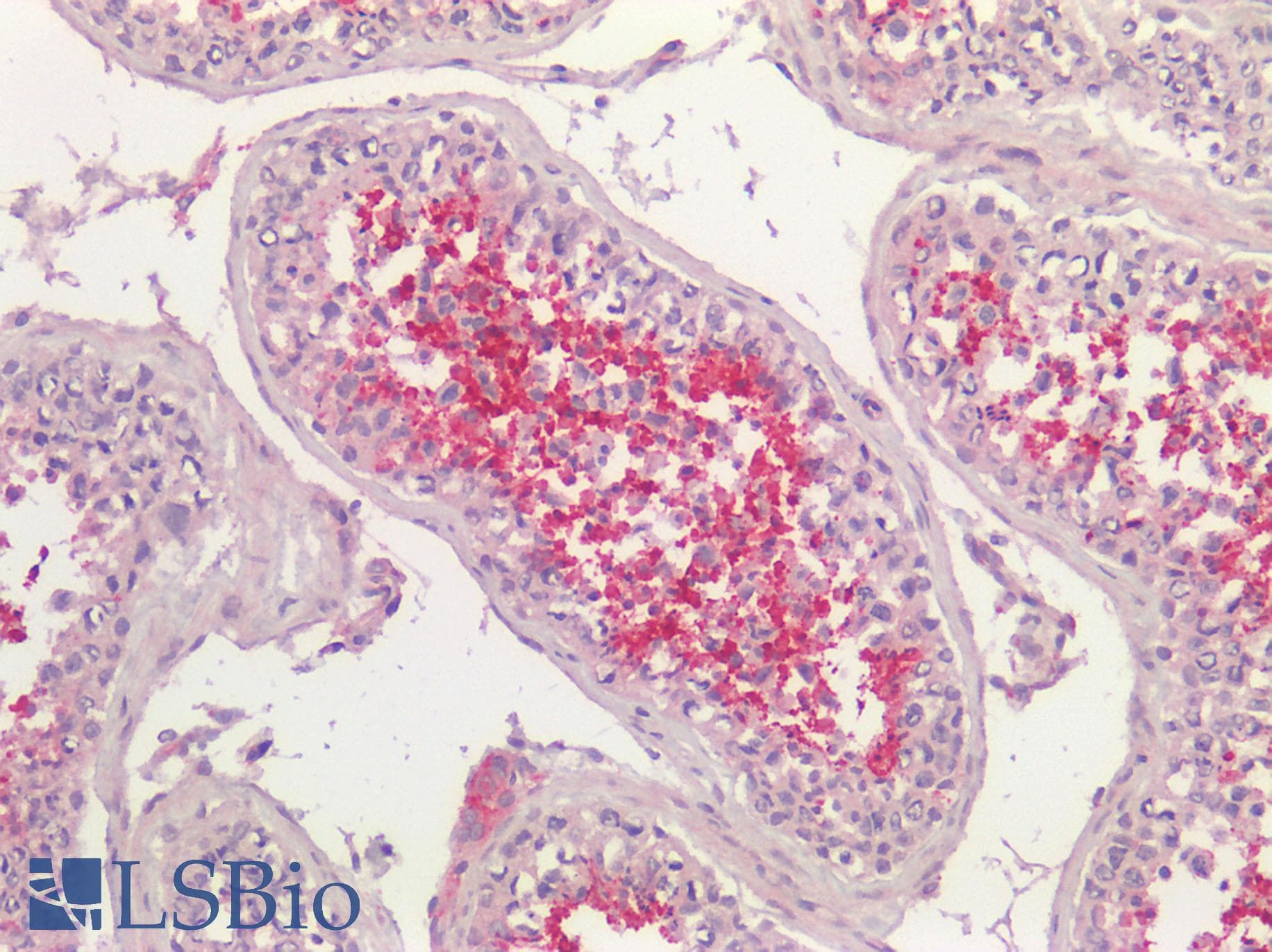 IHC-plus™ Polyclonal Rabbit anti-Human ACE / CD143 Antibody (IHC)