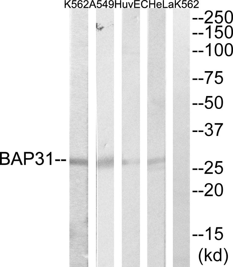BCAP31 / BAP31 Antibody