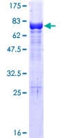 Human VPS4A Protein (Recombinant GST)