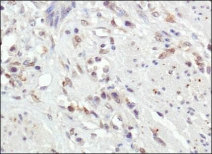 MMP9 / Gelatinase B Antibody (clone 4A3)