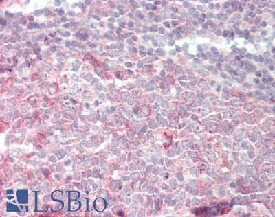 IHC-plus™ Polyclonal Rabbit anti-Human RPS6KB1 / P70S6K / S6K Antibody (aa372-421, IHC, WB)
