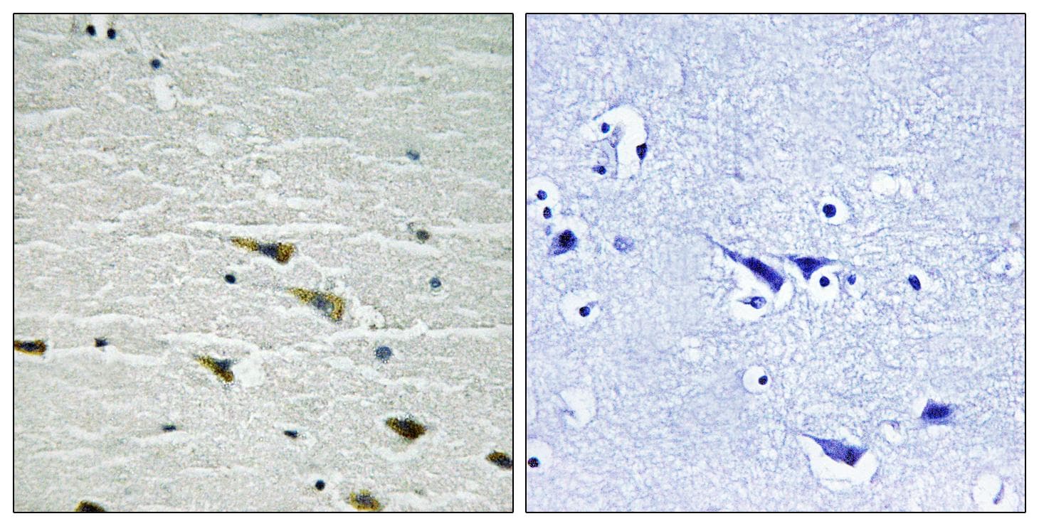 NTRK1 / TrkA Antibody (phospho-Tyr757)