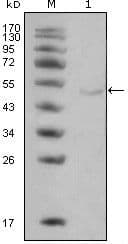 LPL / Lipoprotein Lipase Antibody (clone 2C5)