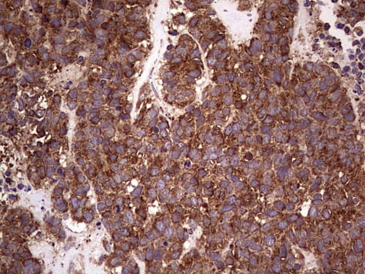RET Antibody (aa713-1017, clone OTI5C5)
