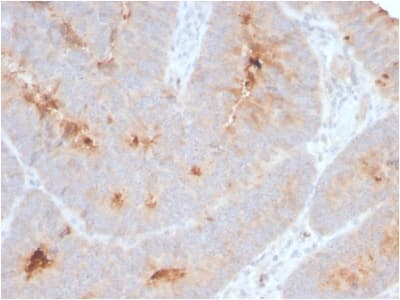 ECM1 Antibody (clone ECM1/2889R)