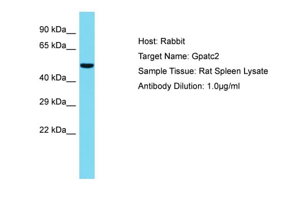 Polyclonal Rabbit anti-Rat GPATCH2 Antibody (aa251-300, WB)