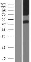 SLC6A13 / GAT-2 Protein (Over-Expression Lysate Myc-DDK (Flag))