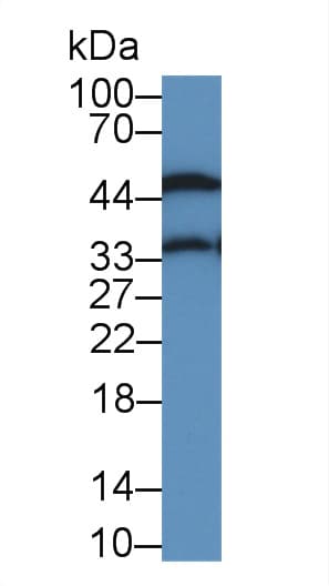 ORM1 / Orosomucoid Antibody