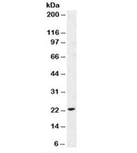 CDKN1A / WAF1 / p21 Antibody (clone DCS-60.2, Azide-free, BSA-free)