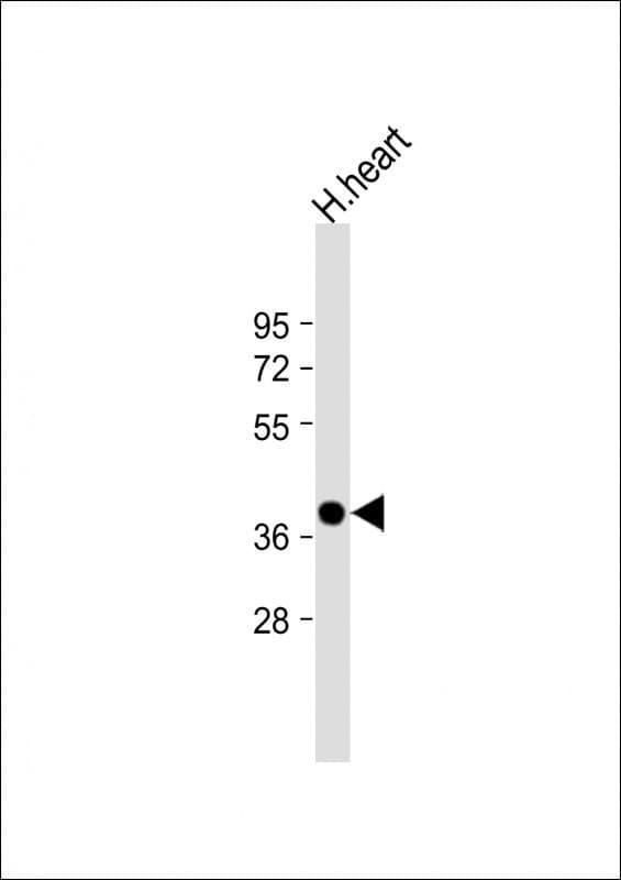 NMNAT1 / NMNAT Antibody (aa200-232)