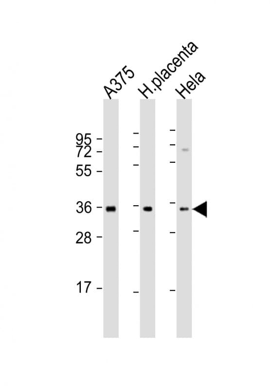FGF5 Antibody (aa140-172)
