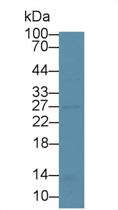 NNMT Antibody (aa127-249, FITC)