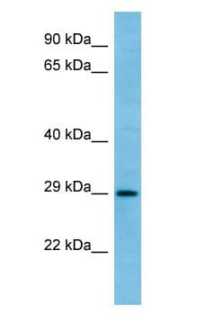 Polyclonal Rabbit anti-Human RAB6C Antibody (aa161-210, WB)