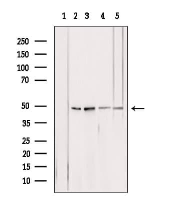 ATP5B / ATP Synthase Beta Antibody