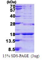 Human SNRPD3 Protein (Recombinant His)