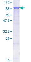 Human ALOX12 / 12 Lipoxygenase Protein (Recombinant GST)