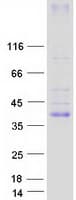Human KCNK17 Protein (Recombinant Myc-DDK (Flag))