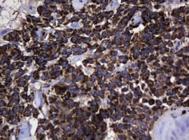 PathPlus™ HSPD1 / HSP60 Antibody (clone OTI3A2)