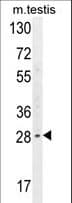 YDJC Antibody (aa169-198)
