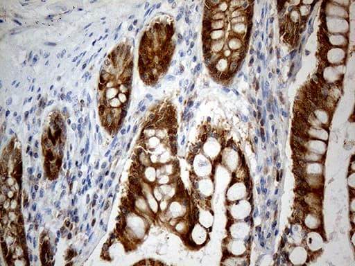 Monoclonal Mouse anti-Human CHCHD10 Antibody (clone OTI3B8, Carrier-free, aa17-142, IHC, WB)