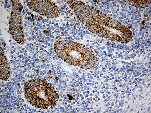 PYCR1 Antibody (aa1-319, clone OTI4F2, Carrier-free)