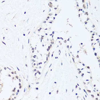 BRIX1 Antibody