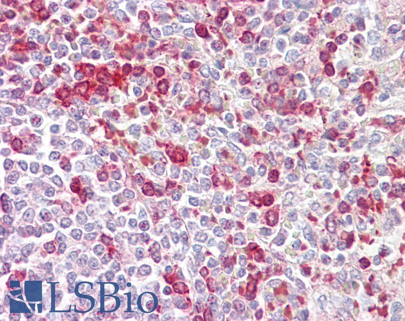 Polyclonal Rabbit anti-Rat CCNA2 / Cyclin A2 Antibody (C-Terminus, IHC, WB)