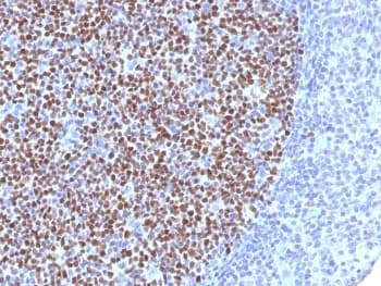 BCL6 Antibody (clone BCL6/1527, Azide-free, BSA-free)