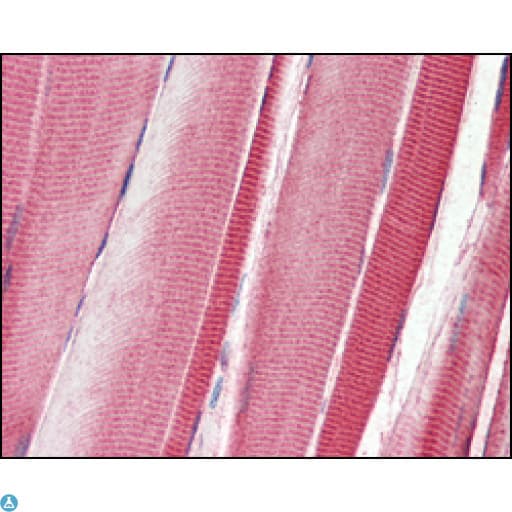 DDR2 Antibody