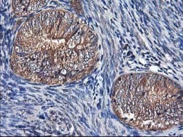 ALS2CR1 / NIF3L1 Antibody (clone OTI4B5)