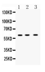 TNFRSF10B / Killer / DR5 Antibody