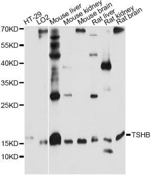 Polyclonal Rabbit anti-Human TSHB / TSH-Beta Antibody (WB)