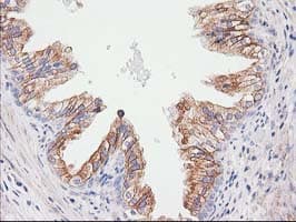 CDCP1 Antibody (clone 2B8, Carrier-free)