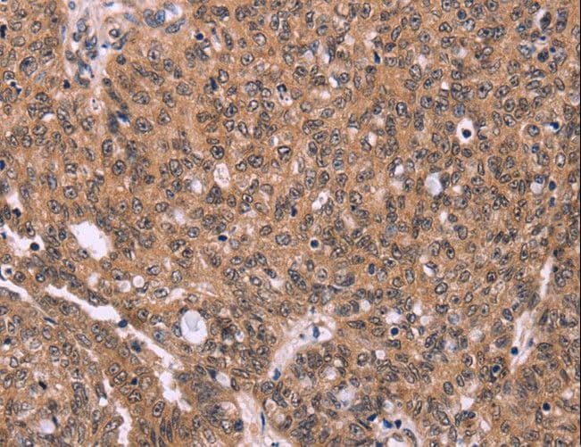 ERAS Antibody